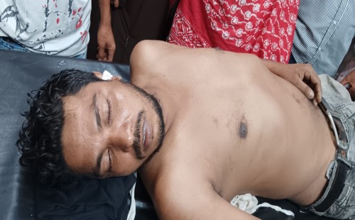 চুয়াডাঙ্গায় পৃথক সড়ক দুর্ঘটনায় শিশুসহ আহত ৫