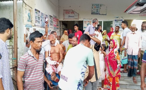 দামুড়হুদার পীরপুরকুল্লায় বৃদ্ধকে কু পি য়ে জ*খমের অভিযোগ