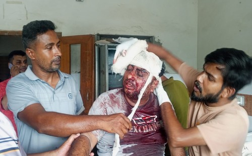 দর্শনায় জুয়েলারি ব্যবসায়ীকে কুপিয়ে জখম; আতঙ্ক