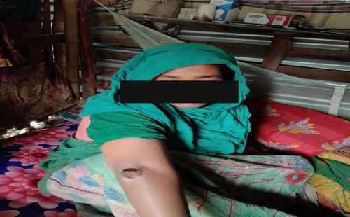 বিয়ের দাবি জানানোয় তরুণীকে গাড়িচাপায় ‘হত্যার চেষ্টা’