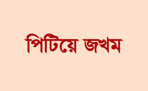 আলমডাঙ্গায় ইটভাটা মালিককে পিটিয়ে জখম
