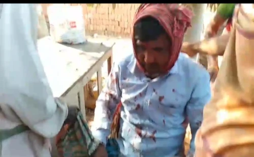 আলমডাঙ্গায় শ্রমিকদের লাঠির আঘাতে ভাটা মালিক আহত, হাসপাতালে ভর্তি