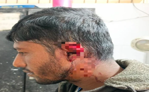 জীবননগর বাঁকা গ্রামে বর্গা জমির কলা কাটা নিয়ে দ্বন্দ্ব