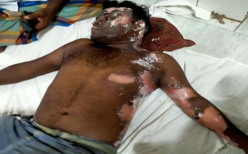 চুয়াডাঙ্গার নয়মাইলে বিদ্যুৎস্পৃষ্টে নির্মাণশ্রমিক গুরুতর আহত
