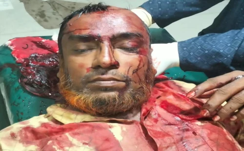জমি নিয়ে বিরোধে শ্রমিক দল সভাপতিকে কুপিয়ে জখম
