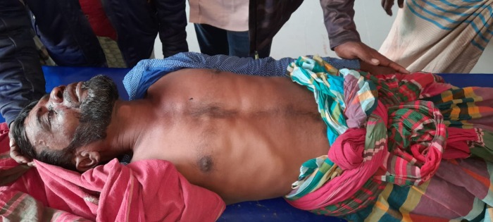 বেগুন কেনা নিয়ে দ্বন্দ্ব, ব্যাপারীর নাকে কোপ!