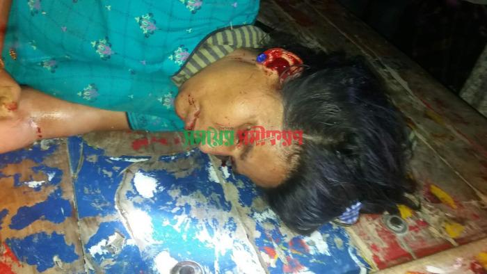 আলমডাঙ্গায় সড়ক দুর্ঘটনায় নারীসহ দুজন আহত