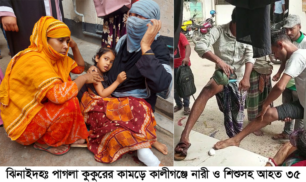 পাগলা কুকুরের কামড়ে নারী-শিশুসহ আহত ৩৫