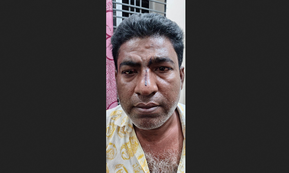 এক ইউপি সদস্যকে পেটালেন অপর মেম্বার