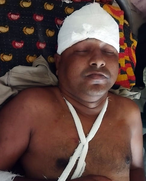 ঝিনাইদহে প্রতিপক্ষের বিরুদ্ধে হাত-পা ভেঙে দেওয়ার অভিযোগ