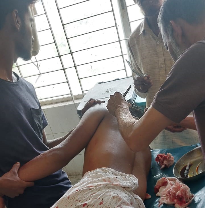চুয়াডাঙ্গায় গাঁজা চুরি নিয়ে দ্বন্দ্বে দুই পক্ষের মধ্যে সংঘর্ষ