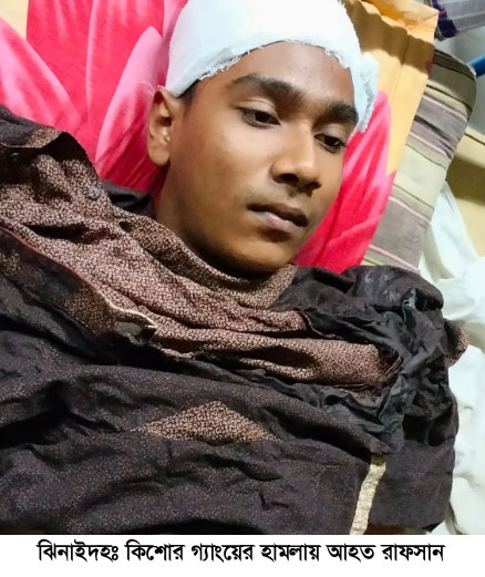 ঝিনাইদহে কিশোর গ্যাংয়ের হামলায় নবম শ্রেণির ছাত্র আহত