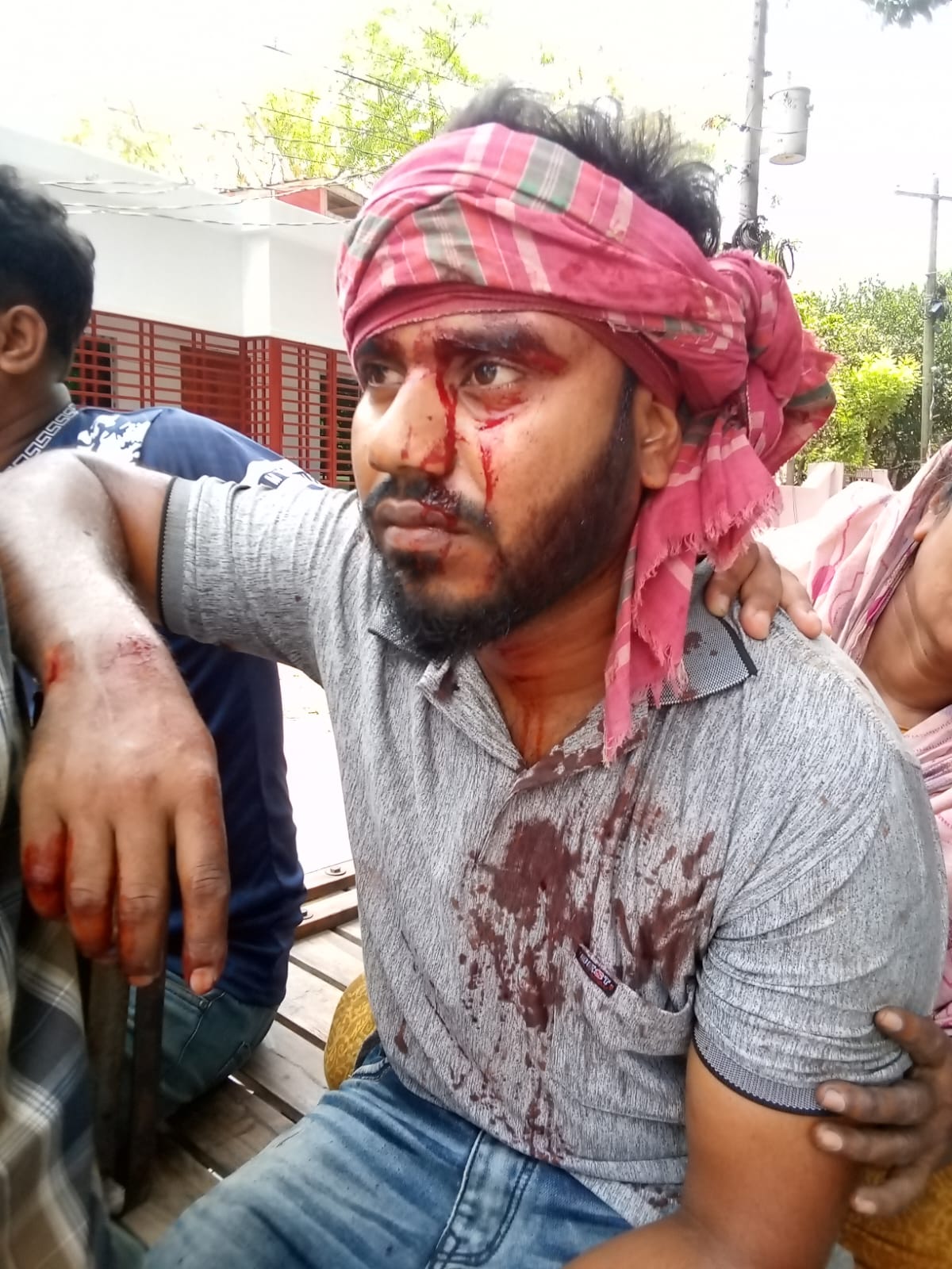 জীবননগরে পরাজিত প্রার্থীর কর্মীর ওপর হামলা