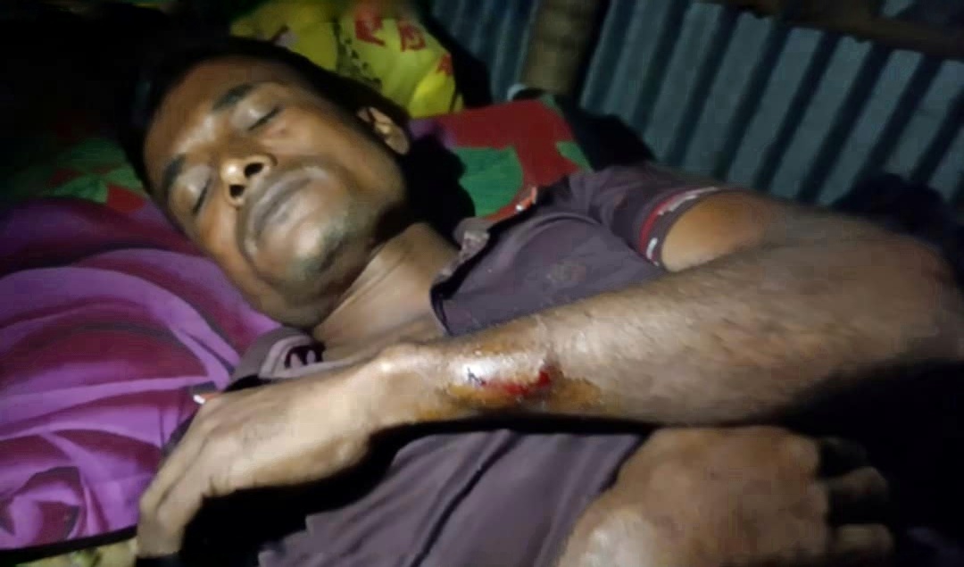 গাংনীতে তুচ্ছ ঘটনায় রামদার আঘাত; আহত ৩