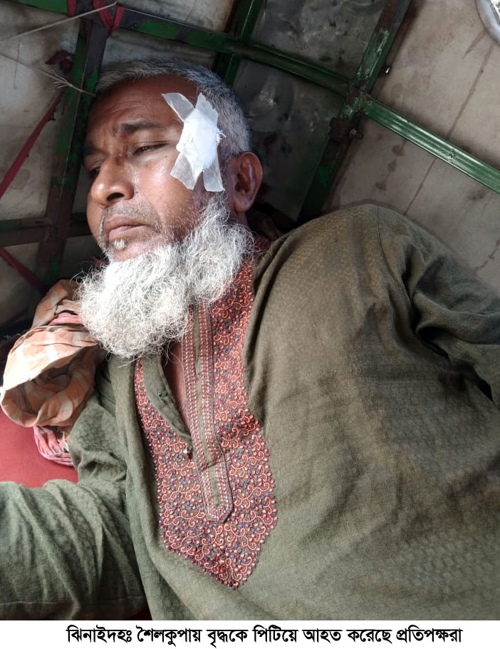 শৈলকুপায় বৃদ্ধকে হাতুড়িপেটা, হাসপাতালে ভর্তি