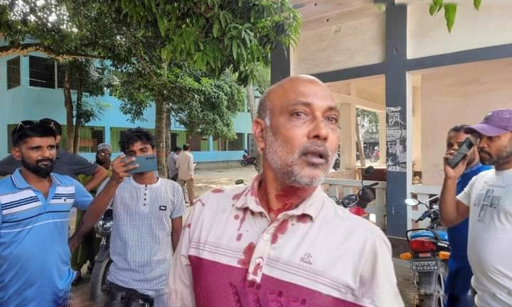 গাংনী ডিগ্রি কলেজের হিসাব সহকারী রবিউলকে পিটিয়ে জখম