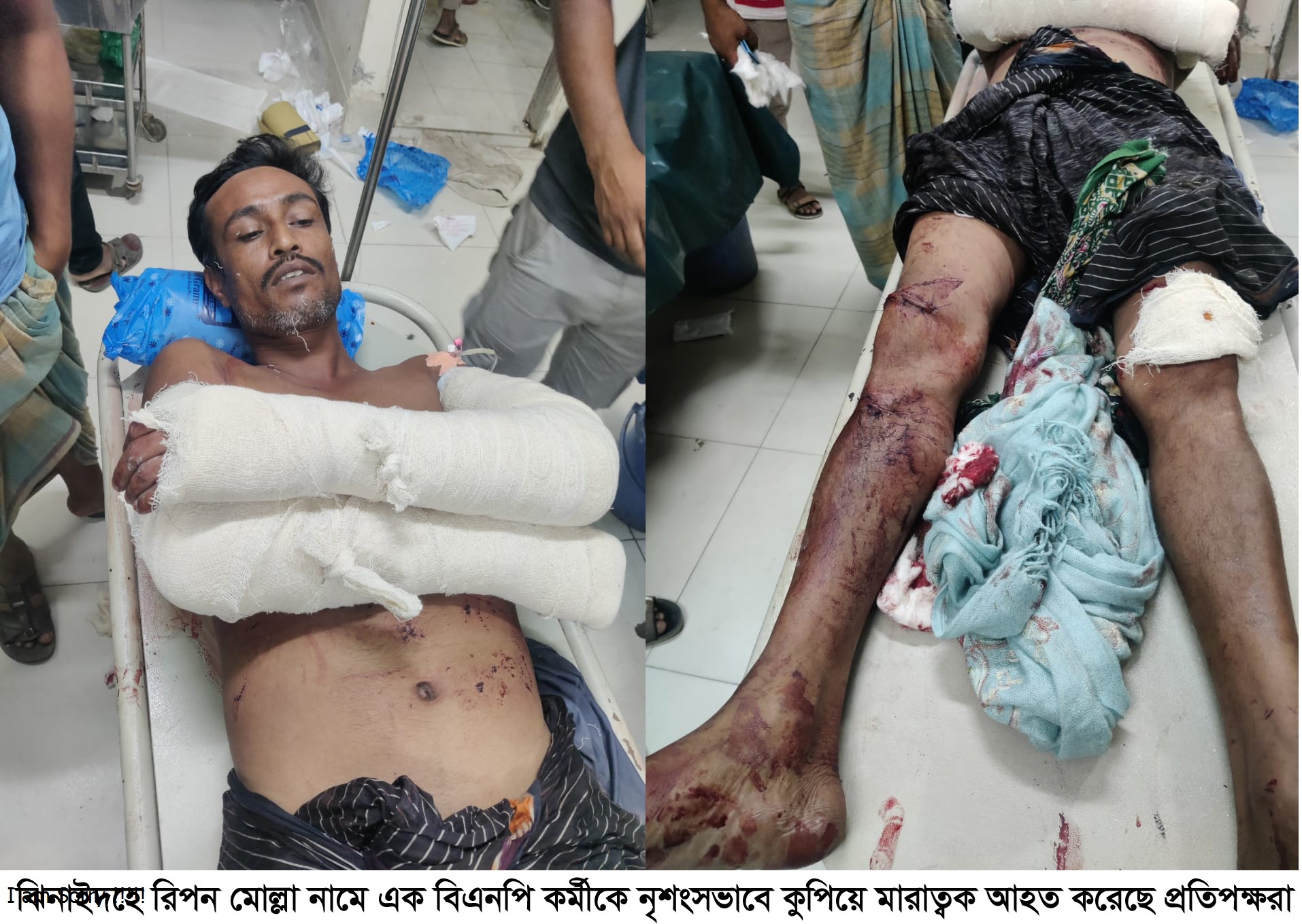 ঝিনাইদহে বিএনপি কর্মীকে কুপিয়ে জখম করেছে প্রতিপক্ষ