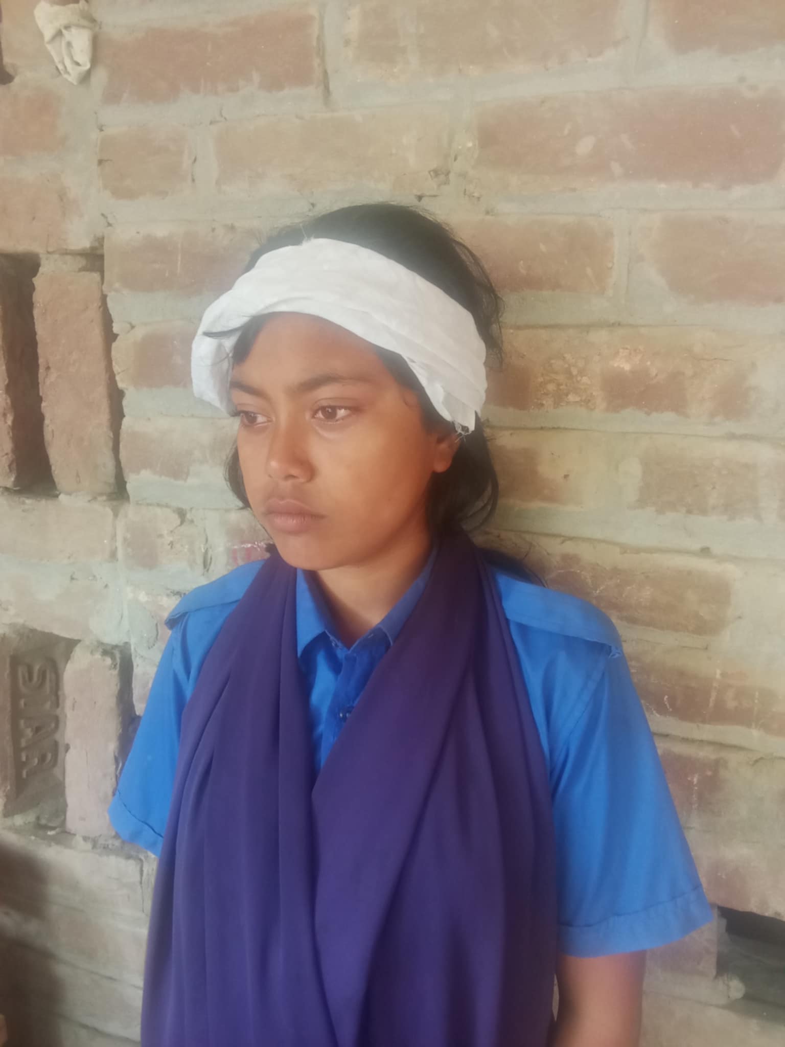 বেগমপুরে ছাত্রীকে মেরে মাথা ফাটিয়ে দিলেন প্রধান শিক্ষক